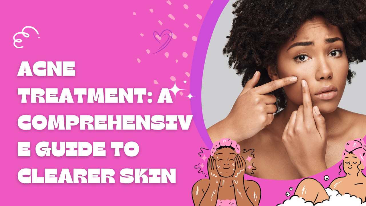 Acne Treatment: A Comprehensive Guide to Clearer Skin